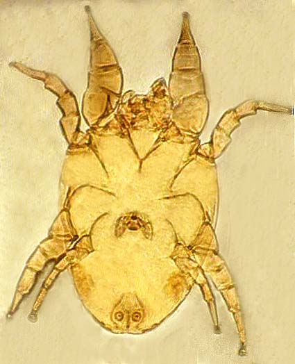 Dermatophagoides farinae