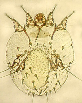 Sarcoptes scabiei
