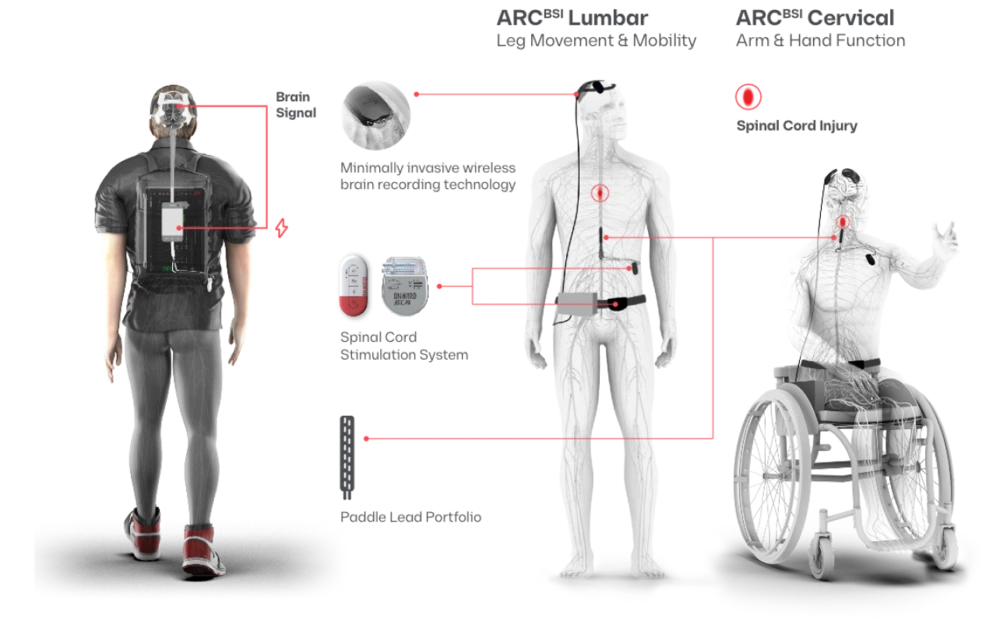 Diagram showing how the ONWARD ARC brain-spine interface connects brain signals to spinal cord stimulation